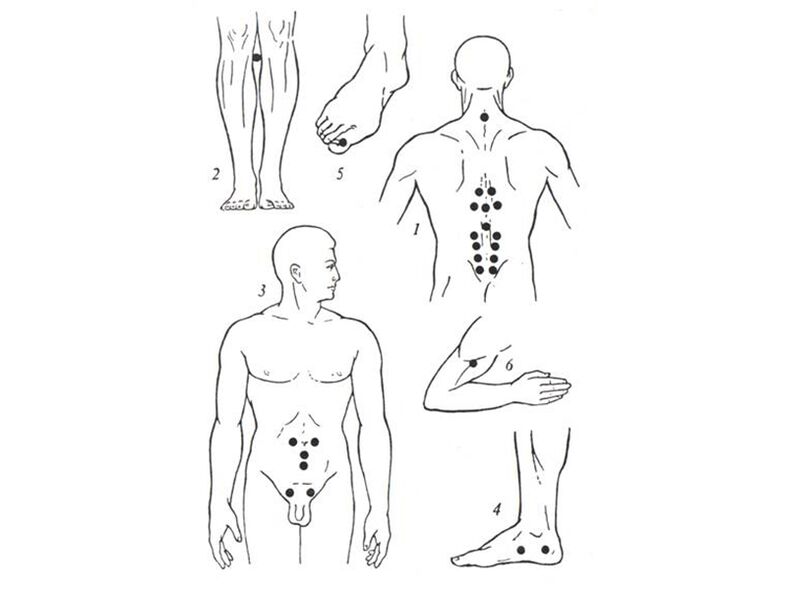 Massage châm cứu