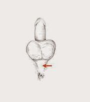 cơ hiệu lực và sự căng thẳng của chúng để tăng hiệu lực